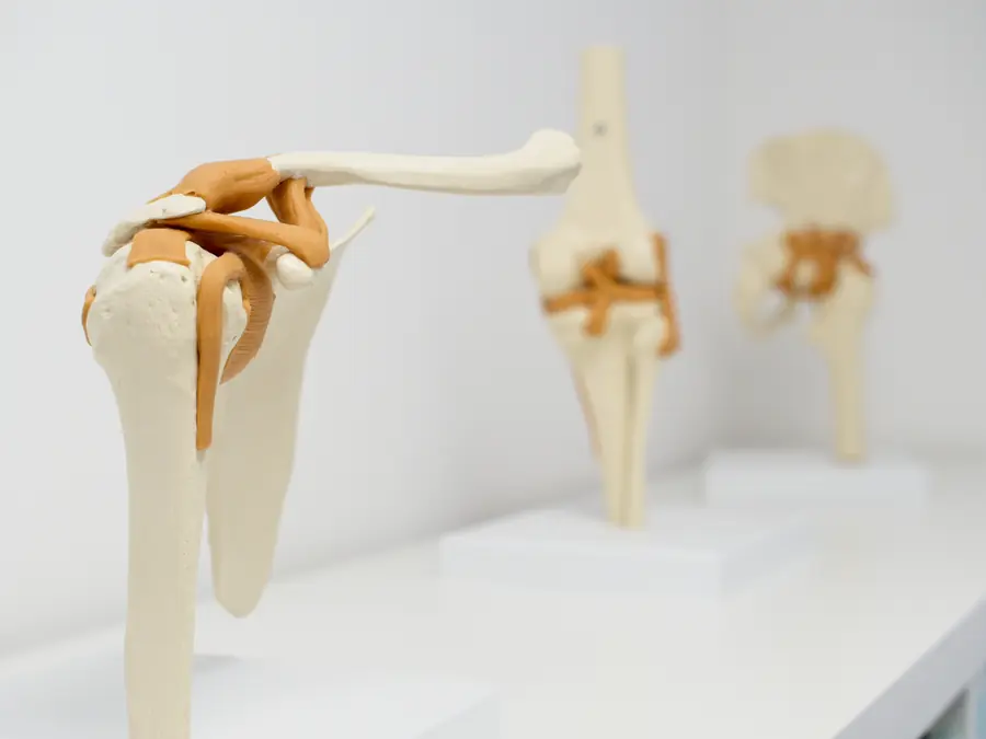 Anatomische Gelenkmodelle (Schulter, Knie, Hüfte) zur Patientenaufklärung